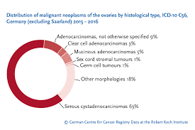 If left untreated, the tumor can spread to other parts of the body. Krebs Ovarian Cancer
