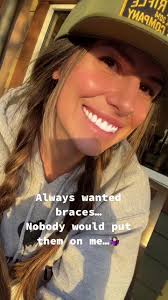 Trend #InstaxChallenge #teeth #bruhgirl #blessed