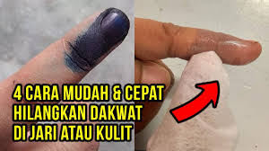 Cara yang terbaik untuk menghilangkan lendir dari saluran hidung adalah dengan menentukan penyebabnya dan mengatasi masalah tersebut. 4 Cara Mudah Dan Cepat Hilangkan Dakwat Kekal Di Jari Dan Kulit Relaxlah My Youtube