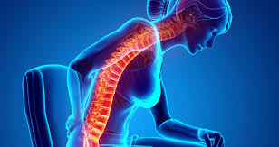 Typing posture corrector in an online search bar will return pages of options. Webmd On Twitter A Poorly Positioned Chair At Work Can Cause You To Slouch Straining The Back Neck More Surprising Pain Triggers Https T Co J1bu8ezkte Https T Co Ii1l2b0ii0