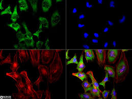 Stream tracks and playlists from smn on your desktop or mobile device. Smn Antibody 2b1 Nb100 1936 Novus Biologicals