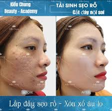 Kiều Chung Beauty Spa