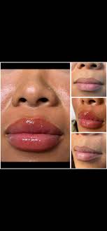 Lips by Dr Collins Text (229)669-7076 to learn about the current promo and  to schedule your appointment at Salon Fusion