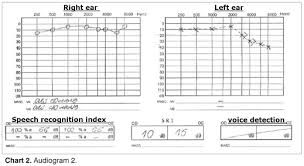 sudden deafness as a presenting symptom of acoustic neuroma