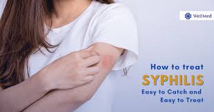 Image result for syphilis symptoms