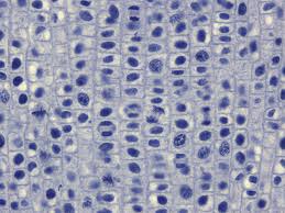 The images shown below were taken using a regular light microscope with an oil immersion lens at 1000x. Why Do We Use Onion Root Tips To Study Mitosis