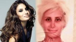 Bir Zamanlar Cukurova Nin Zuleyha Si Hilal Altinbilek Estetiksiz Haliyle Sok Etti