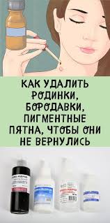 как удалить родинку в домашних условиях за 5 минут Pin Na Doske Doglyad Za Shkiroyu