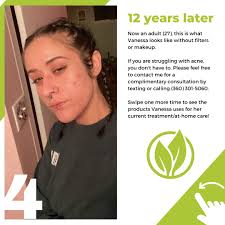 face of grace pure skin care