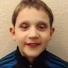 The right way to perform an eyelid scrub. 1