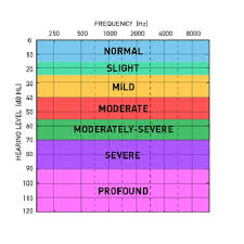 what is an audiogram understanding hearing test results