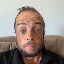 Do distilleries offer allocated drops when they open?