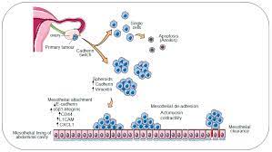 Ovarian cancer is a disease that affects women. Ijms Free Full Text Therapeutic Targeting Of Collective Invasion In Ovarian Cancer Html