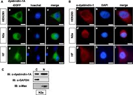 La bloc a fost unul dintre cele mai indragite si mai longevive seriale romanesti. Nucleocytoplasmic Shuttling Of Dysbindin 1 A Schizophrenia Related Protein Regulates Synapsin I Expression Journal Of Biological Chemistry