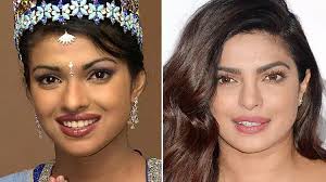 Top 6 Bollywood Celebrities Who Have Undergone Plastic Surgery have undergone plastic surgery