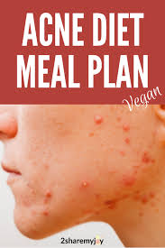 Hormonal Acne Diet Plan Best 7 Day Clear Skin Meal Plan Pdf Clear Skin Diet Acne Diet Acne Diet Plan