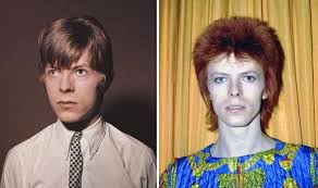David bowie was one of the world's most influential musicians. David Bowie Real Reason Behind Ziggy Stardust S Mismatched Eyes Exposed Celebrity News Showbiz Tv Express Co Uk
