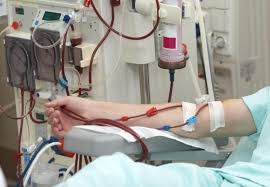 Dialysis Procedure Purpose Types Side Effects And More Kidney Dialysis Dialysis Kidney Failure