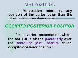Image result for Manual Rotation in Occipitoposterior Presentation
