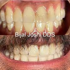 Joshi is a gentle, caring dentist who uses the most advanced materials and procedures available. Chino Aesthetic Dental 12555 Central Ave Ste B Chino Ca Dentists Mapquest