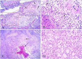 Aspergillosis occurs in chronic or acute forms which are clinically very distinct. Frontiers Pathogenicity And Immune Responses Of Aspergillus Fumigatus Infection In Chickens Veterinary Science