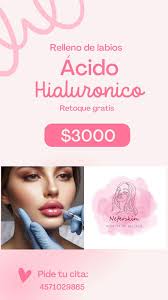 Realizamos rellenos faciales Rinomodelacion Labios Nasogenianos Arrugas muy  marcadas