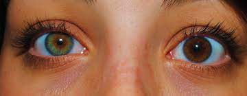 Acuvue oasys with hydraclear plus contact lenses. Does Reddit Like My Different Colored Eyes Multi Colored Eyes Different Colored Eyes Cool Eyes