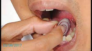 Maybe you would like to learn more about one of these? 7 Obat Sakit Gigi Alami Yang Bekerja Sangat Cepat