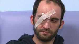 He was the second of three children. Wigston Attack Biker Loses Eye When Hit By Thrown Egg Bbc News