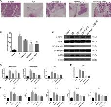 Necrotizing pancreatitis is a complication of acute pancreatitis. Inhibition Of Ripk1 Dependent Regulated Acinar Cell Necrosis Provides Protection Against Acute Pancreatitis Via The Ripk1 Nf Kb Aqp8 Pathway Experimental Molecular Medicine