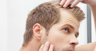 Parlando di capelli maschili, la . Calvizie Maschile Eta Quando Cadono I Capelli E Cosa Fare