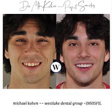 Mike Kohen (@dr.mikekohen.perfectsmiles) • Instagram photos and videos