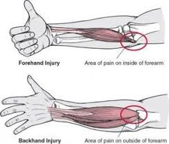 One of these situations, for example, is a shorter ball a common mistake at the club level is to lock the wrist when hitting a forehand and swinging from the shoulder. Pin On Occupational Therapy