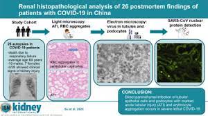 He was politically rehabilitated in 1978. Renal Histopathological Analysis Of 26 Postmortem Findings Of Patients With Covid 19 In China Kidney International