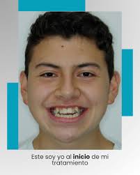 Franklin Ortiz Ortodoncia (@ortizgaray27) • Instagram photos and videos