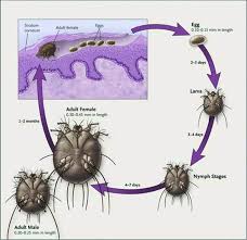 Image result for Sarcoptes scabiei