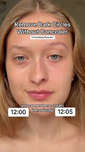 What to Do with under Eyes When U Cant Wear Makeup