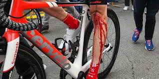 Le néerlandais tom dumoulin, insuffisamment remis d'une blessure à un genou, déclare forfait pour le tour de france, une course qu'il a dumoulin a chuté le 15 mai, dans la 5e étape du giro, qu'il a abandonné le lendemain. Tom Dumoulin Muss Auf Die Tour De France Verzichten