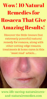 Best Natural Remedies Home Treatments For Rosacea Https Www Life Saving Natural Natural Remedies For Rosacea Rosacea Treatment Home Remedies For Rosacea