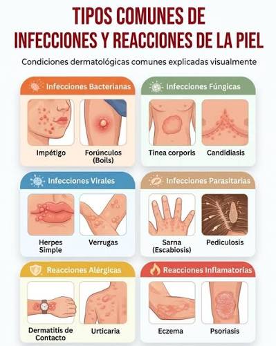 No todas las erupciones en la piel son iguales! Identificar correctamente  el tipo de problema es el primer paso para el alivio y la cura.