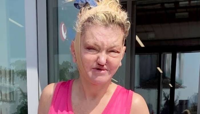 Danniella Westbrook confesses she's lost confidence in her appearance
