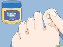 How To Help A Toenail Grow Back Quickly Toe Nails How To Grow Nails Nail Growth
