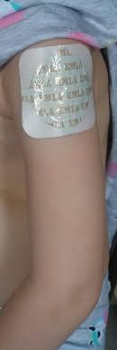 Smerter over leddet, oftest uden udstråling. Vaccinationer