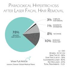 When it comes to pain level, laser hair removal falls somewhere between shaving. Paradoxical Hypertrichosis Beware Of Laser Hair Removal