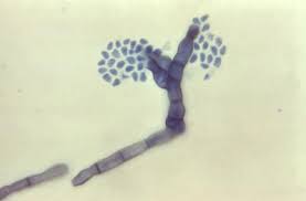 Fonsecaea pedrosoi (brumpt) negroni, rev. Fonsecaea Compacta Wikipedia