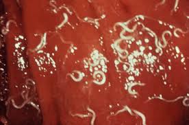 Image result for Whipworm