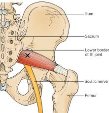 You don't have to look any further. Piriformis Syndrome Structura Body Therapies