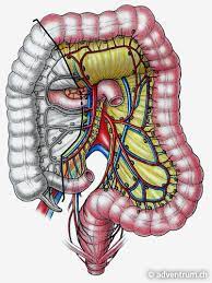 You can clearly see the full colon. Dickdarmentfernung Adventrum