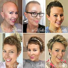 These wigs are ideal for cancer, chemo and alopecia patients. 6 Months Edited My Cancer Chic Hair Growth Stages Hair Growth After Chemo Hair Growth Pictures
