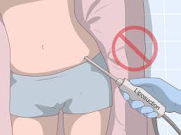 Ich achte auf meine ernährung und trainiere bewegung: Cellulite Loswerden Wikihow